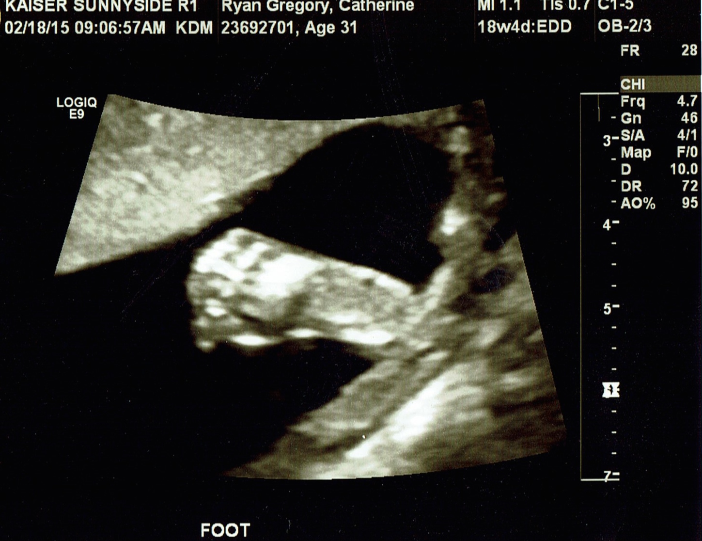 Kiwi feet ultrasound - Ten Thousand Hour Mama